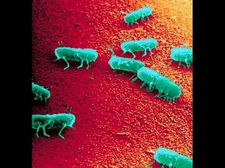 NEWBORN BABY INFECTIONS 4