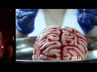 iZombie Clip: "Zombie Bro" ...And so it begins.