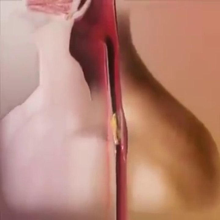 FROM EAT TO DIGEST COMPLETE VIDEO