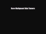 Download Rare Malignant Skin Tumors [Download] Online