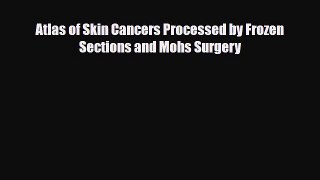 Download Atlas of Skin Cancers Processed by Frozen Sections and Mohs Surgery [PDF] Online