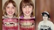 Bad Teeth (Before And After Braces)