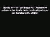 Download Thyroid Disorders and Treatments: Underactive and Overactive Glands: Understanding