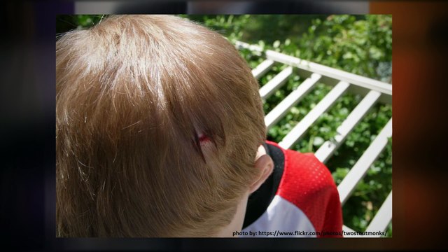 Child Injury Claims, Child Injury Lawyer - Parslows Lawyers