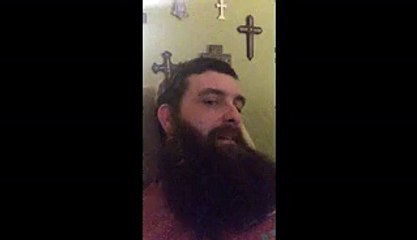 Snake Slithers Through Mans Beard