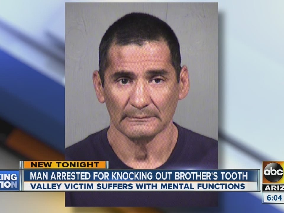 Man arrested for knocking out brother’s tooth