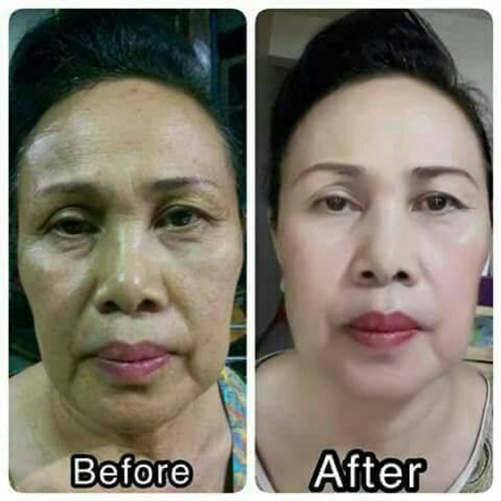 RAHSIA BAGAIMANA MENGHILANGKAN KESAN JERAGAT DAN BINTIK HITAM