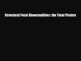 Download Structural Fetal Abnormalities: the Total Picture [Read] Full Ebook