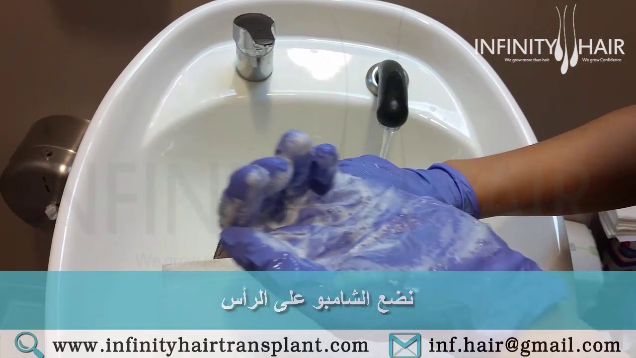 طريقة غسل شعر الرأس بعد عملية زراعة الشعر - إنفينيتي هير Infinity Hair