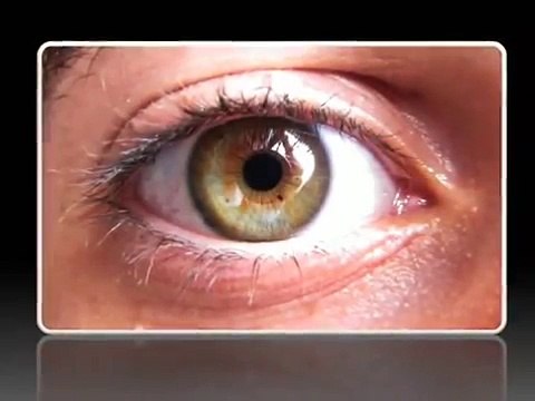 Miopía y astigmatismo