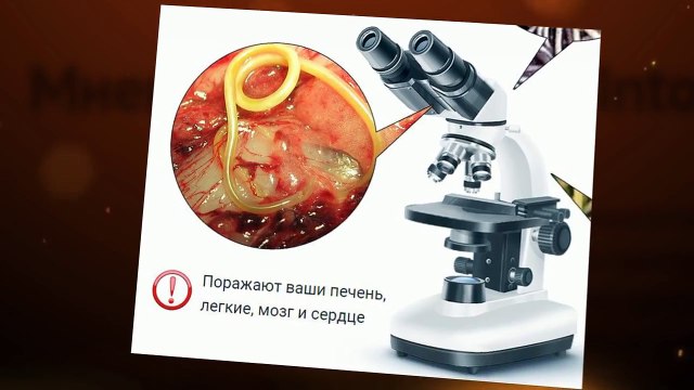 Как полностью избавится от паразитов, глистов за 30 дней! Intoxic® надежное средство от паразитов!