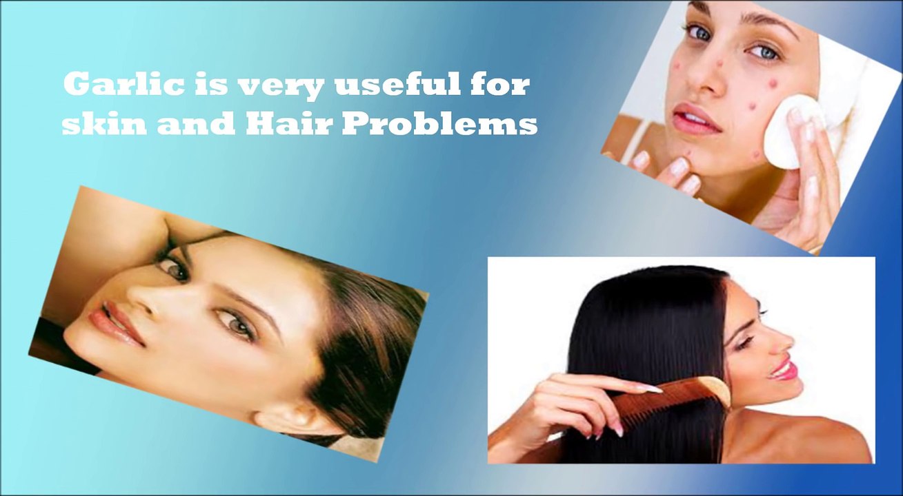 Benefits of Garlic for weight loss, Acne, Hair and Cholesterol (Hindi)  लहसुन के स्वास्थ्य लाभ