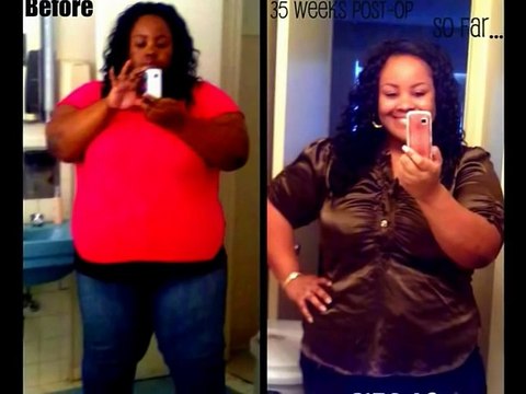 -124 Plus Pounds lost! Before and After Weightloss (Pics)