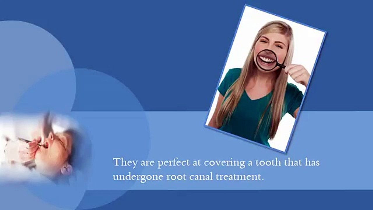 Using Fixed Bridges to Restore Your Smile and Replace Your Missing Teeth