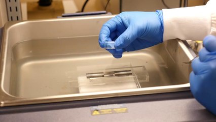 Nuevo implante menos invasivo repara la columna vertebral