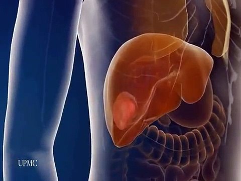 Laparoscopic Liver Surgery 3D Animation