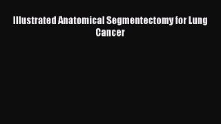 Download Illustrated Anatomical Segmentectomy for Lung Cancer [Download] Online