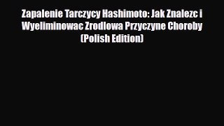 Read ‪Zapalenie Tarczycy Hashimoto: Jak Znalezc i Wyeliminowac Zrodlowa Przyczyne Choroby (Polish‬