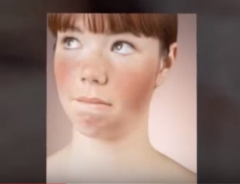 How To Stop Blushing For No Reason! We Can Help Stop Chronic Blushing I Did It So Can You!!