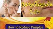 How to remove acne or pimple mark I چہرے سے دانے اور داغ ختم کرنا I How to Get Rid of Pimples and Pimple Marks Fast I Best home remedies to remove pimple marks