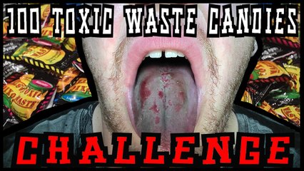 100 Toxic Waste Candies Challenge *WARNING: BLOOD*