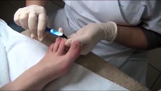 Pedicure Taglio unghie del piede