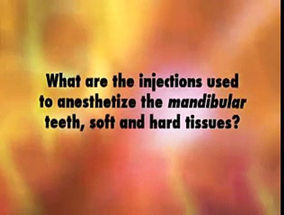 Mandibular Local Anesthesia Injection Techniques