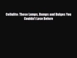 Read ‪Cellulite: Those Lumps Bumps and Bulges You Couldn't Lose Before‬ PDF Free