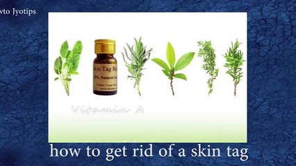 Come rimuovere le appendici cutanee-metodo fai da te-