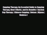 Download ‪Cupping Therapy: An Essential Guide to Cupping Therapy How it Works and Its Benefits