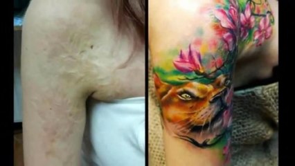 Amazing Scar-Covering Tattoos - Epic Cover Up