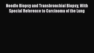 Download Needle Biopsy and Transbronchial Biopsy With Special Reference to Carcinoma of the