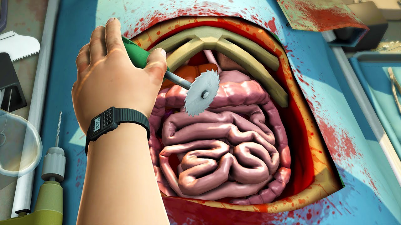 KWEBBELKOP-OPERATION GONE HORRIBLY WRONG