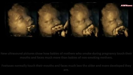 Les effets de la cigarette sur le foetus