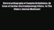 Read Electrocardiography of Complex Arrhythmias An Issue of Cardiac Electrophysiology Clinics