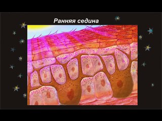 Как избавиться от седины