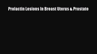 Read Prolactin Lesions In Breast Uterus & Prostate PDF Free