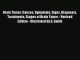 Read Brain Tumor: Causes Symptoms Signs Diagnosis Treatments Stages of Brain Tumor - Revised