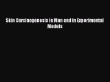 Read Skin Carcinogenesis in Man and in Experimental Models PDF Free