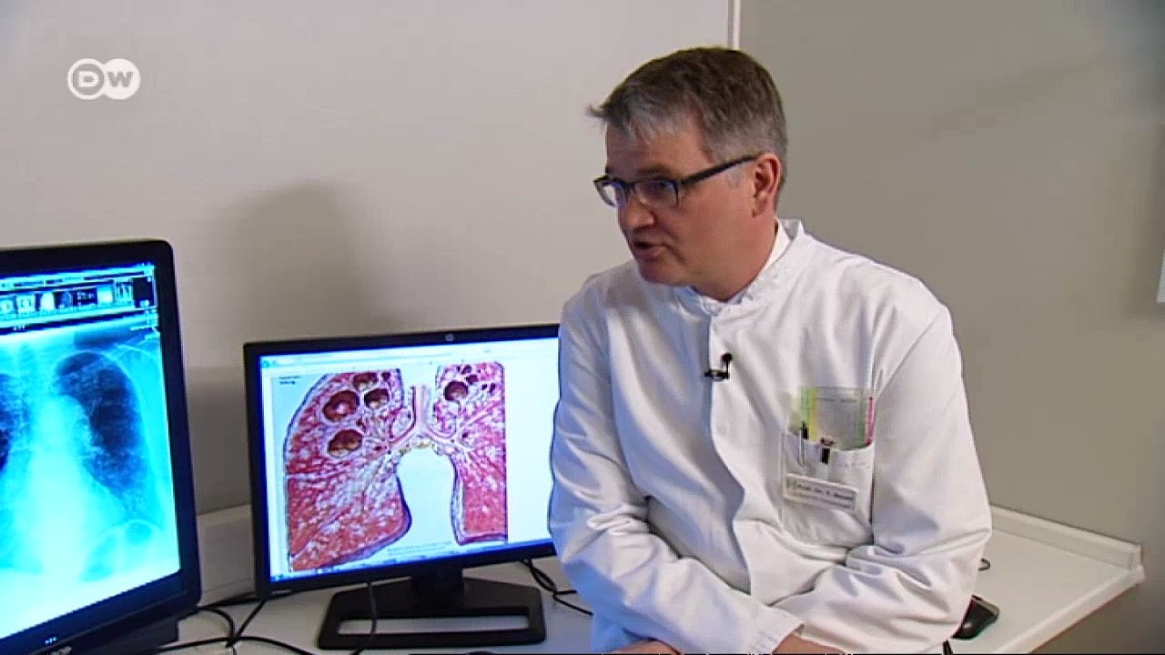Diagnosing tuberculosis | In Good Shape