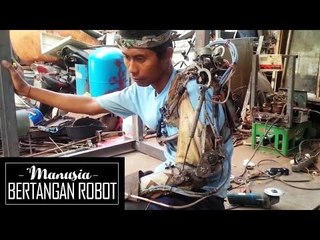 Kisah Manusia Bertangan Robot di Bali