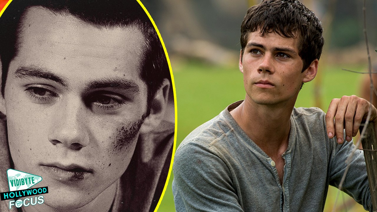 Dylan O'Brien Injured On Maze Runner Set