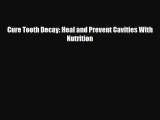 Read ‪Cure Tooth Decay: Heal and Prevent Cavities With Nutrition‬ Ebook Free