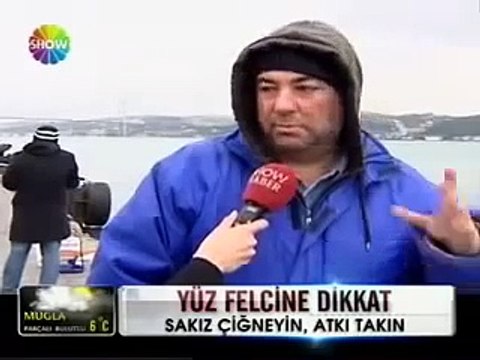 Yüz Felci Tedavisi Yüz Felci Neden Olur ve Nasıl Geçer-Yüz Felçleri Nasıl Tedavi Edilir
