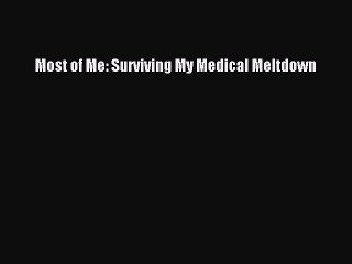 Read Most of Me: Surviving My Medical Meltdown Ebook Free