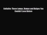 [PDF] Cellulite: Those Lumps Bumps and Bulges You Couldn't Lose Before [Download] Online