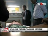 TKW Asal Lombok Disiksa Majikan di Malaysia