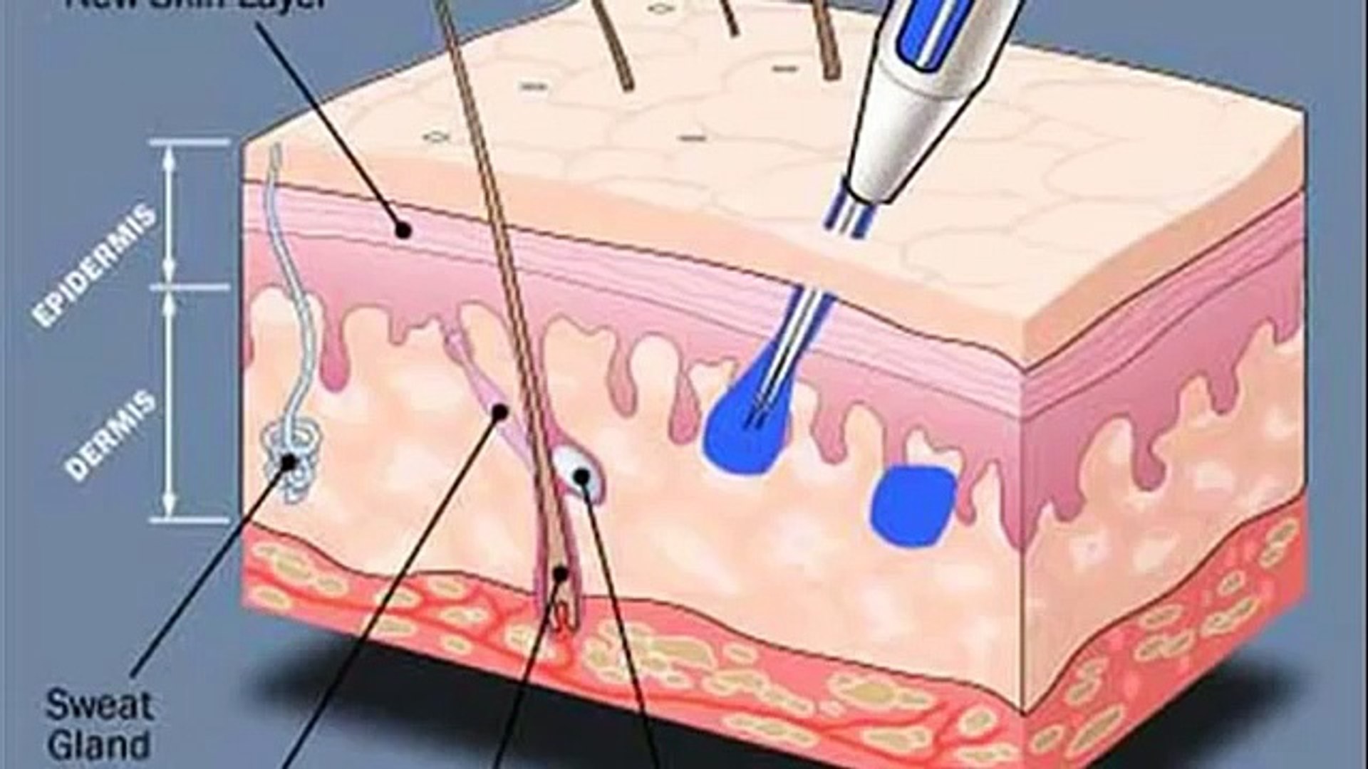 ⁣tattoo needle depth