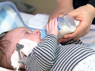 Mehmet bebek, çenesi uzatılarak yaşama tutundu