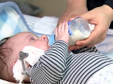 Mehmet bebek, çenesi uzatılarak yaşama tutundu